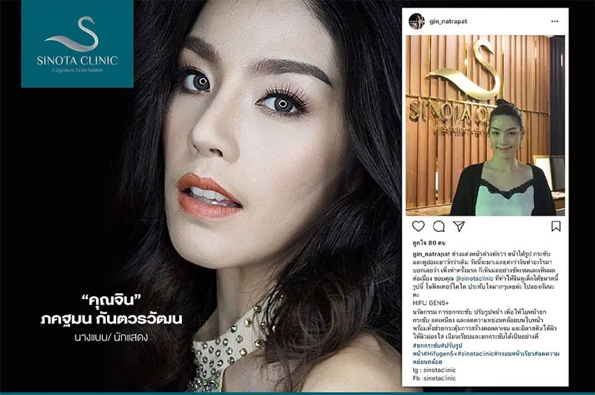 สำหรับสาวจิน ภคฐมน กันตวรวัฒน ด้วยอาชีพนางแบบ/นักแสดง เพราะในชีวิตทุกวันต้องแต่งหน้าเสมอ จึงตัดสินใจเลือก HIFU Gen 5 Plu...