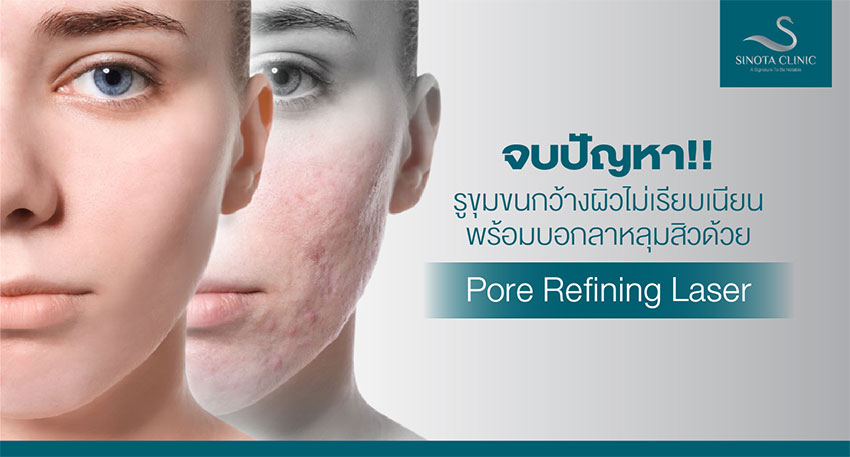 Pore Refining Laser