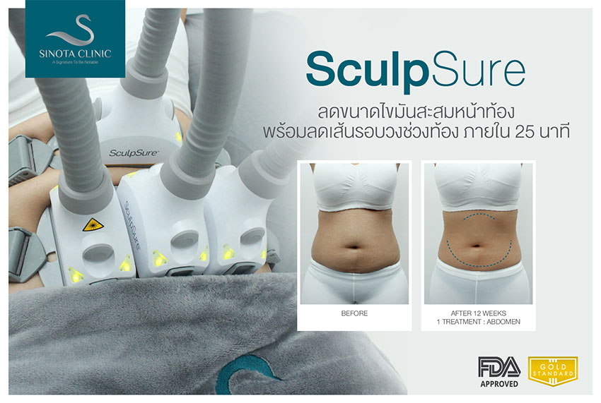 สลายไขมัน sculpsure สลายไขมัน sculpsure