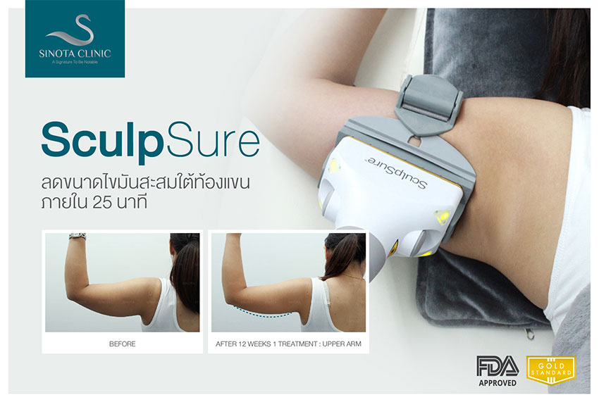 สลายไขมัน sculpsure สลายไขมัน sculpsure