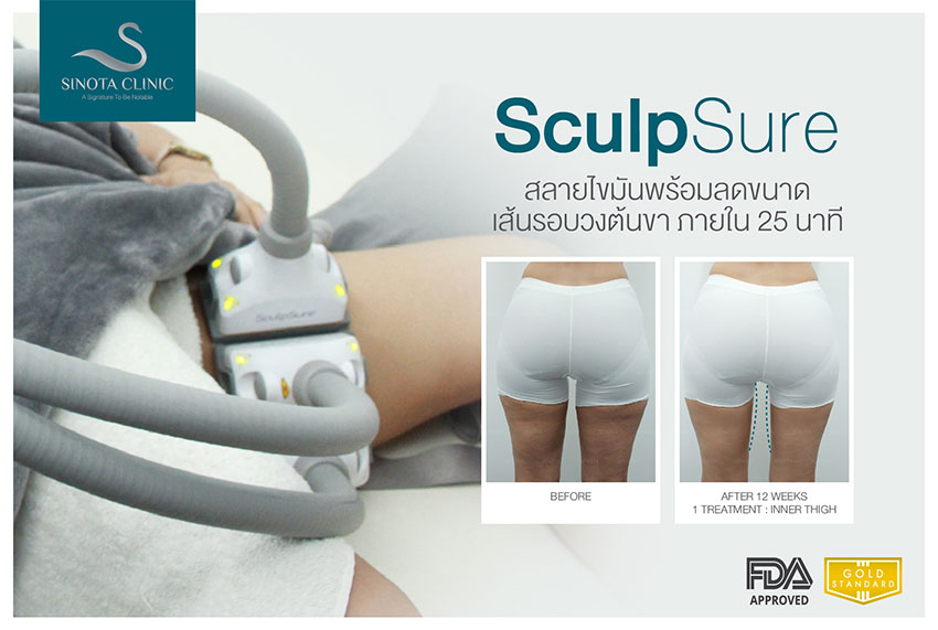 สลายไขมัน sculpsure