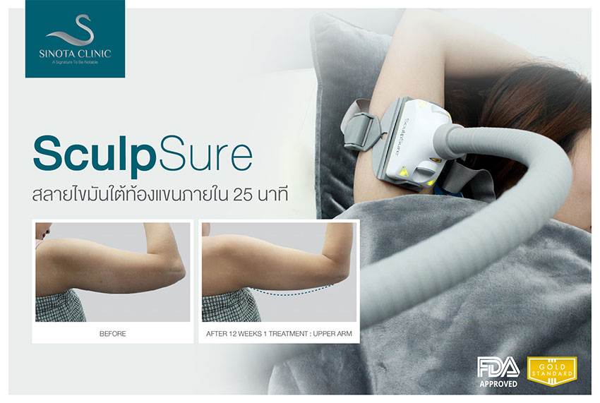 สลายไขมัน sculpsure สลายไขมัน sculpsure