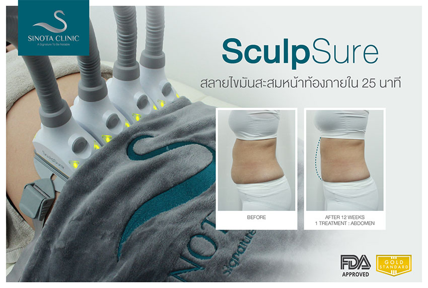 สลายไขมัน sculpsure สลายไขมัน sculpsure