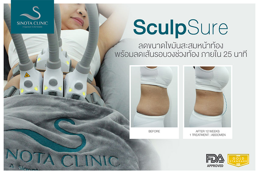 สลายไขมัน sculpsure สลายไขมัน sculpsure
