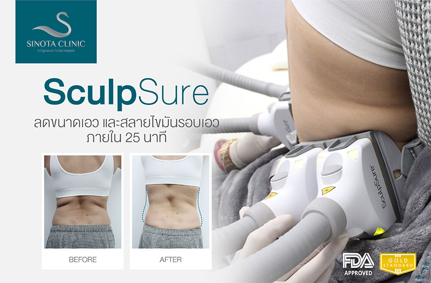 sculpsure สลายไขมัน sculpsure สลายไขมัน
