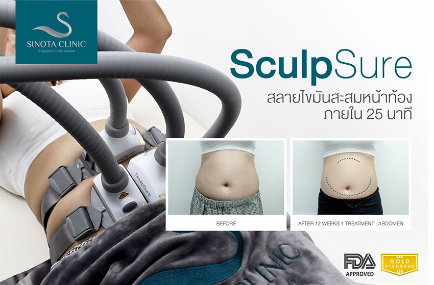 sculpsure สลายไขมัน sculpsure สลายไขมัน