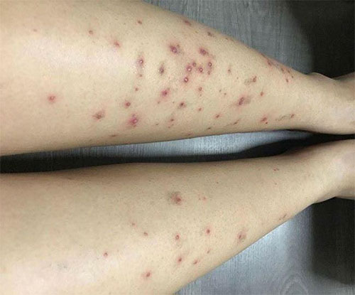 คุณยุ้ย กันธิชา ฉิมศิริ