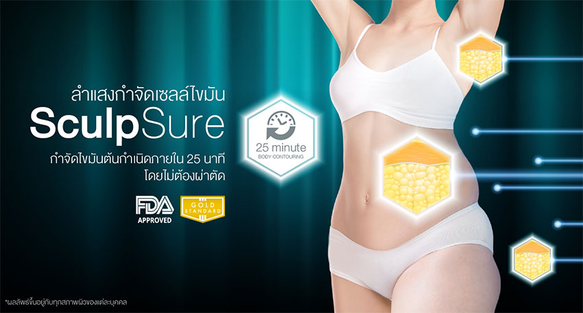 sculpsure
