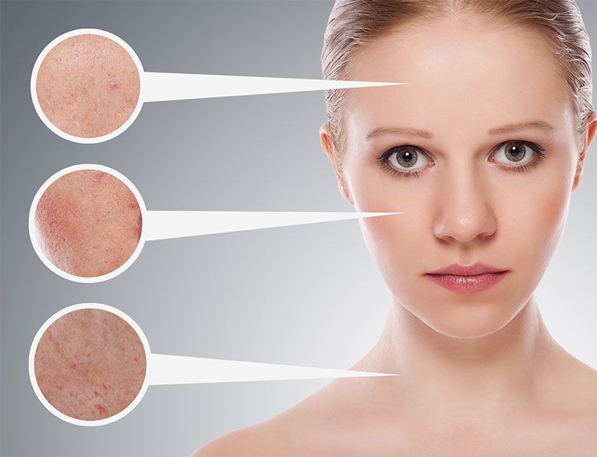 รูขุมขนกว้างทำอย่างไรด