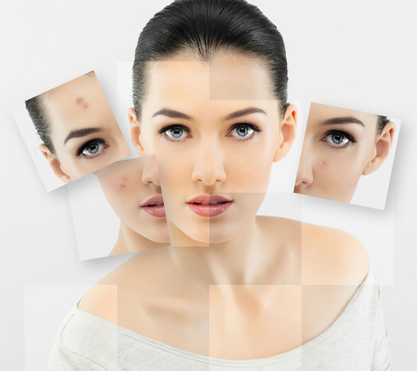 รูขุมขนกว้างทำอย่างไรด