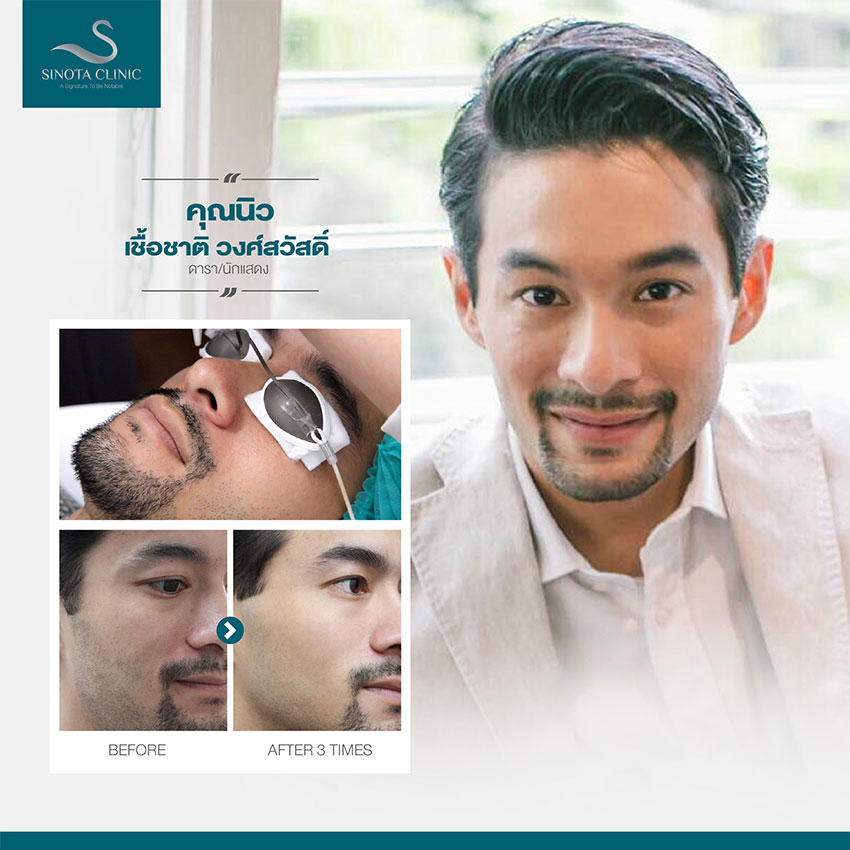 รูขุมขนกว้าง