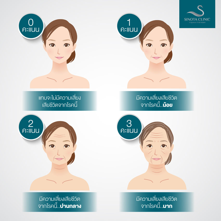 ลายหน้าผากบอกอนาคต