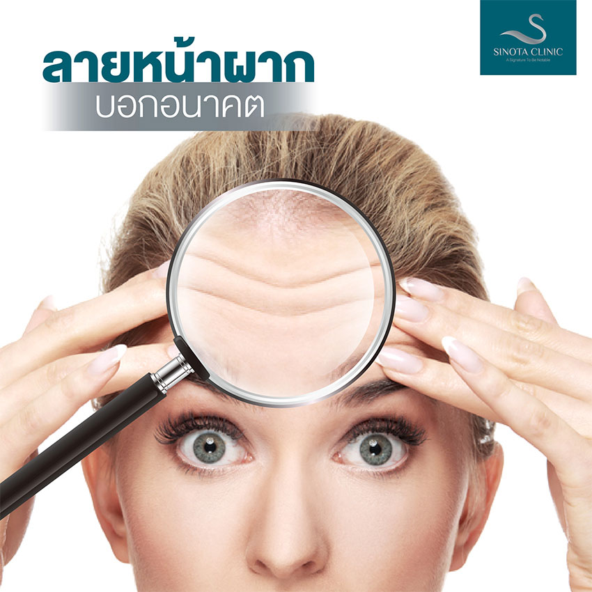 ลายหน้าผากบอกอนาคต