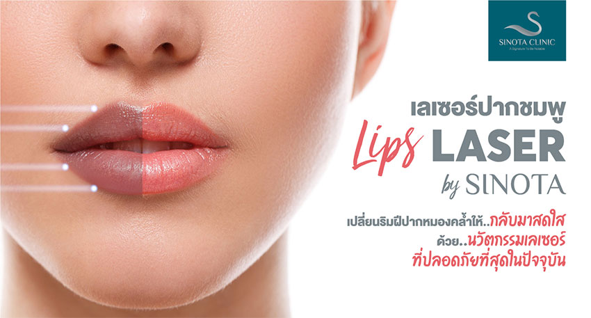 ปากดำ ปากคล้ำ แก้ยังไง? ต้องให้ Lips Laser เลเซอร์ปากชมพูเป็นตัวช่วย