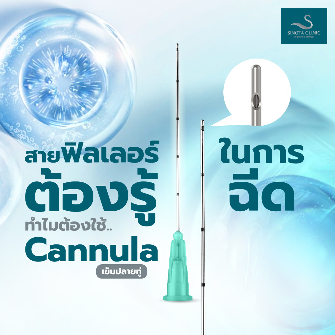 สายฟิลเลอร์ต้องรู้ ทำไมต้องใช้ Cannula ในการฉีด - Sinota Clinic