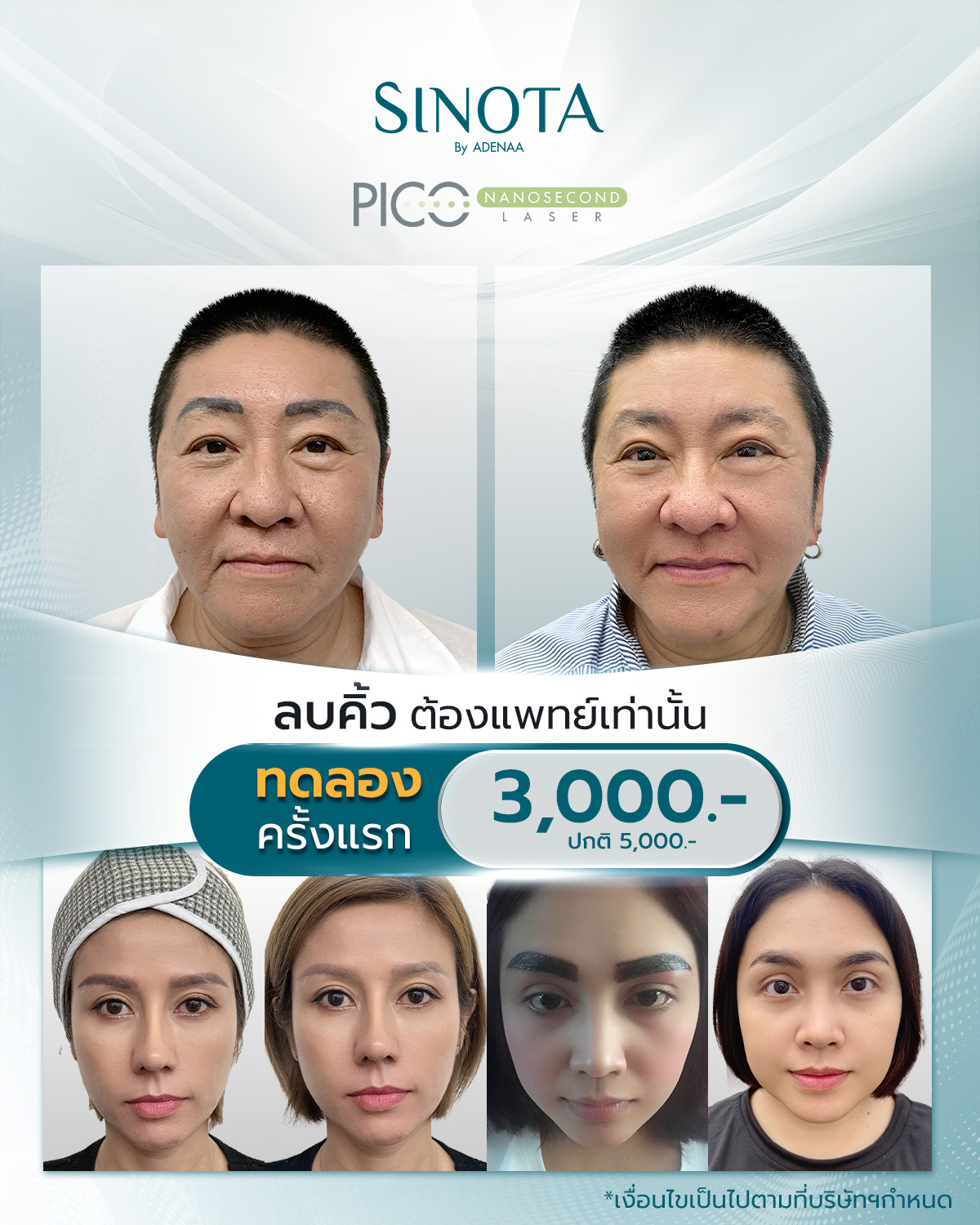 ทำไมต้อง 