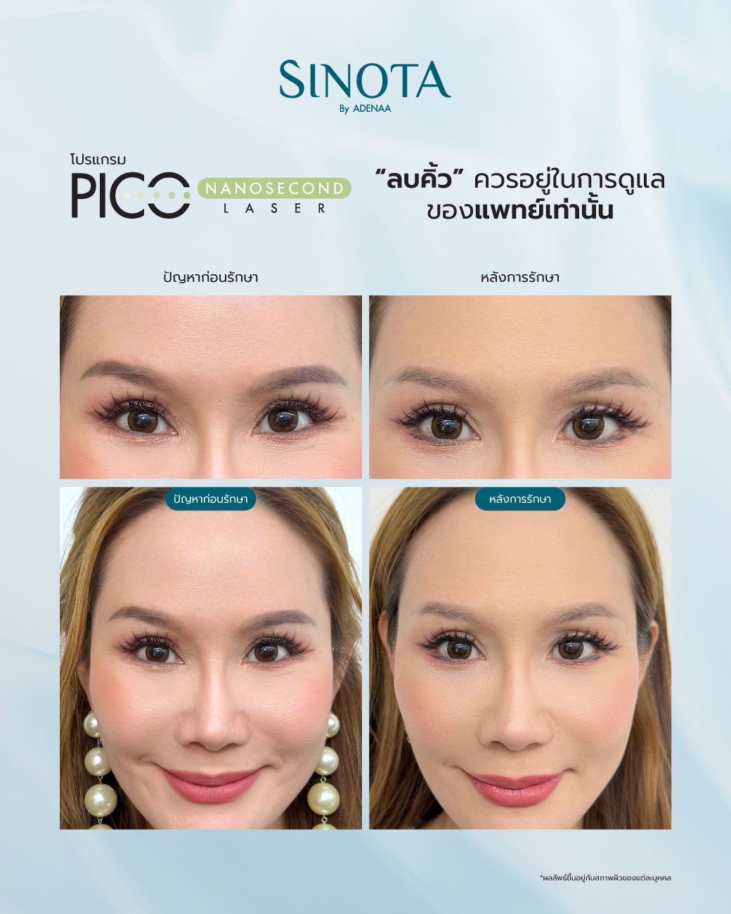 ทำไมต้อง 