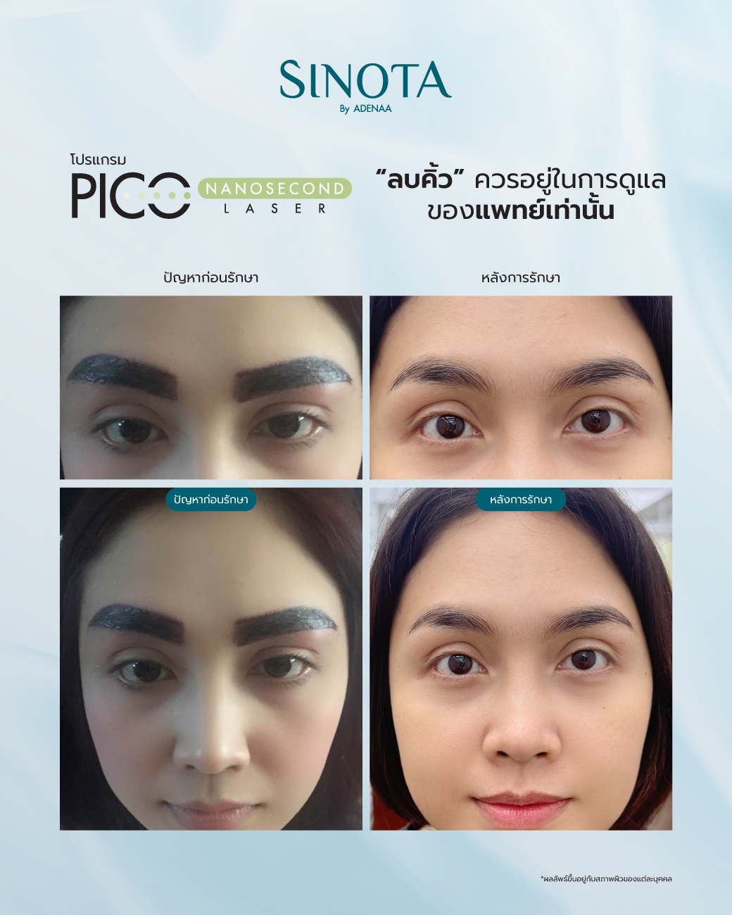 ทำไมต้อง 