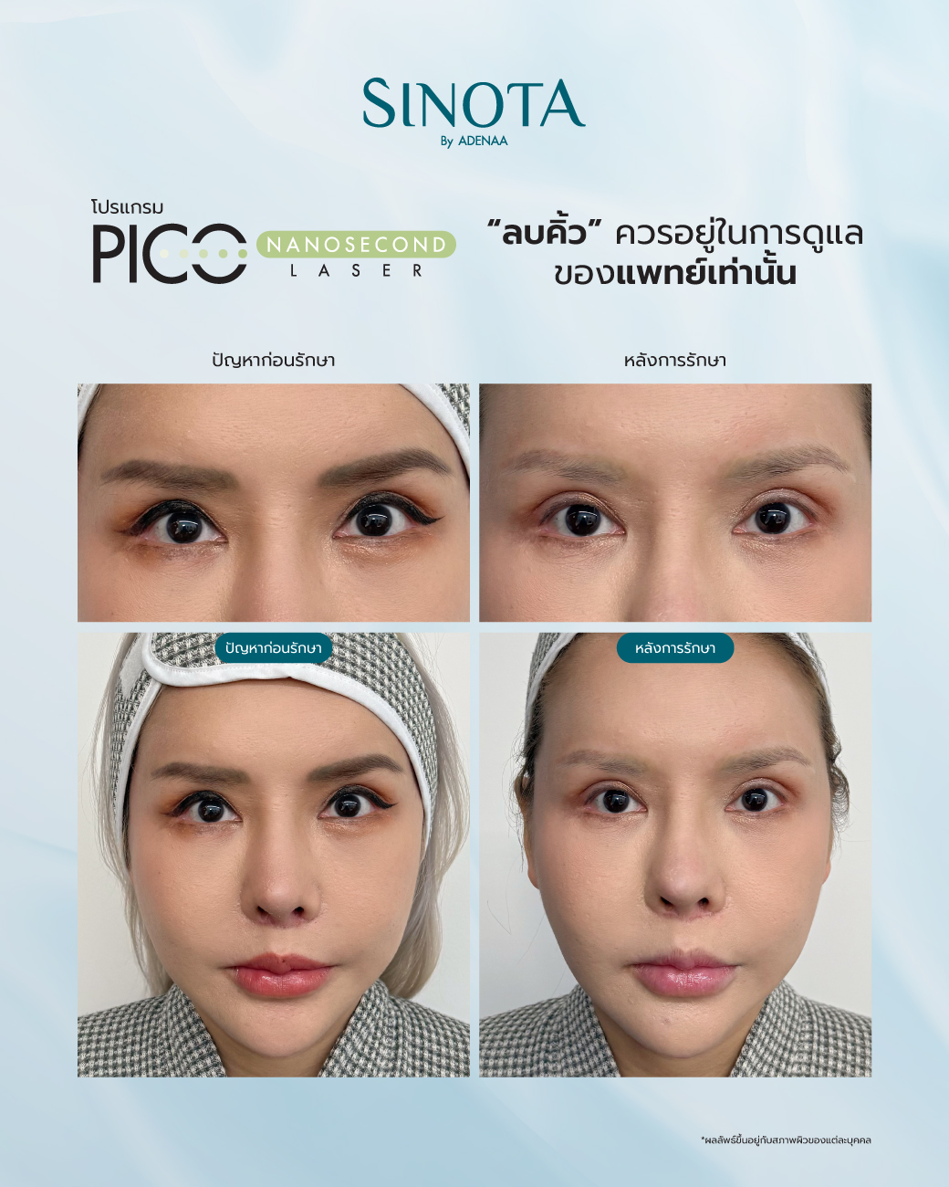 ทำไมต้อง 
